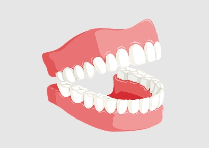 Wisdom Tooth Extraction – What to Expect